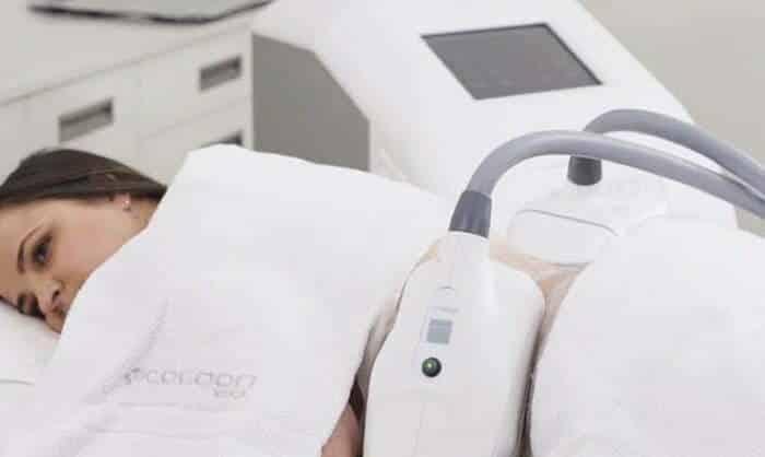 Kriolipoliza Cooltech