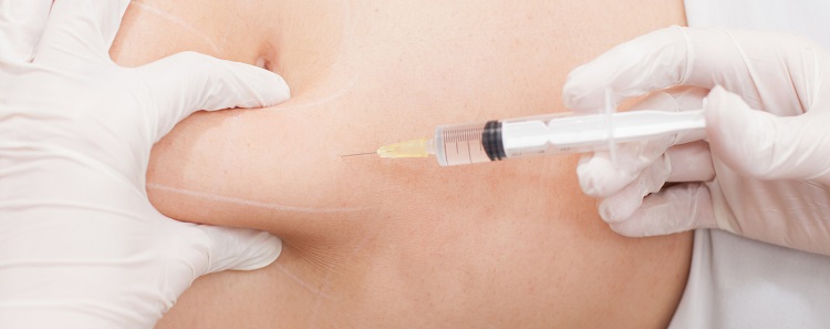 zabiegi medycyny estetycznej