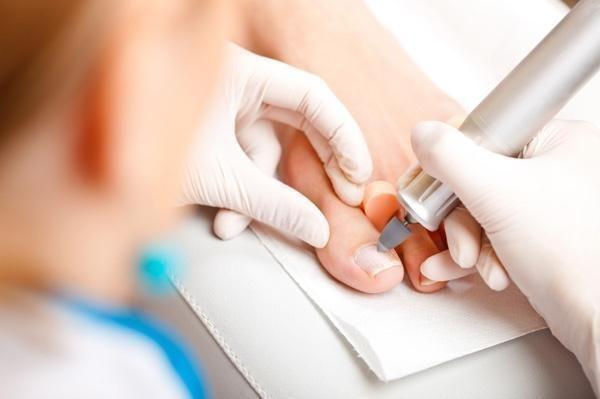 pedicure_leczniczy_bydgoszcz